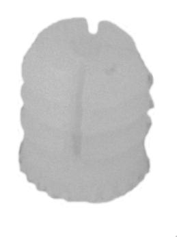 Závrtná matica M6/10x13mm nylon